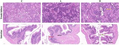 RNA-Seq and 16S rRNA Analysis Revealed the Effect of Deltamethrin on Channel Catfish in the Early Stage of Acute Exposure